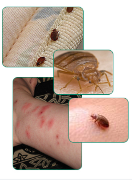 Bed Bugs 3